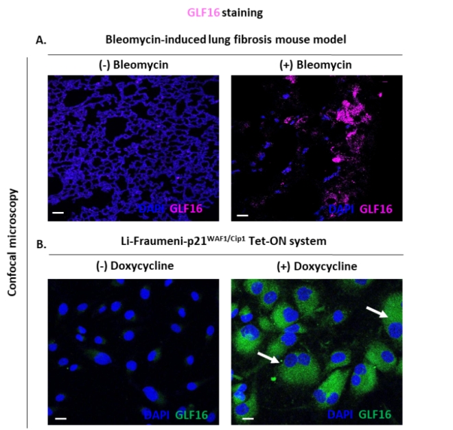 GLF16 staining of lung tissue sections and cellular models of induced senescence